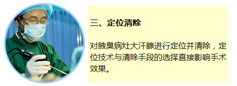 腋臭手术(图文)