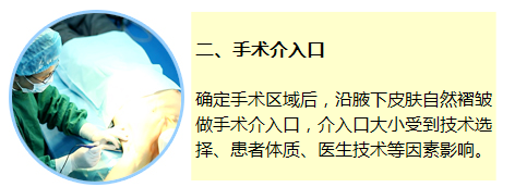 腋臭手术(图文)